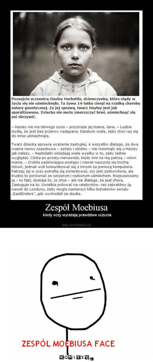 Zespó? moebiusa –  