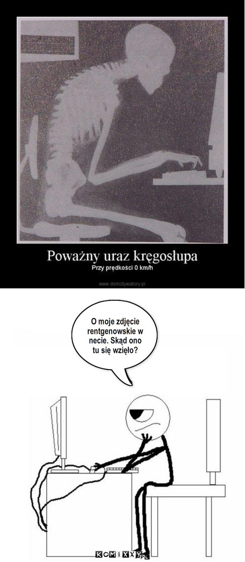 Zdjęcie lenia   – O moje zdjęcie rentgenowskie w necie. Skąd ono tu się wzięło? 