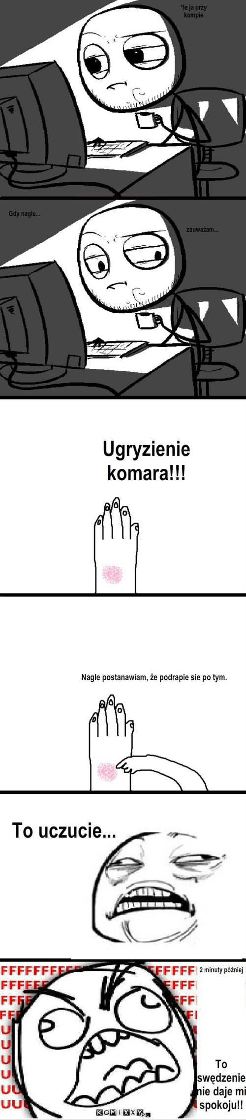 Ugryzienie komara – *le ja przy kompie Gdy nagle... zauważam... Ugryzienie komara!!! Nagle postanawiam, że podrapie sie po tym. To uczucie... 2 minuty później To swędzenie nie daje mi spokoju!! 